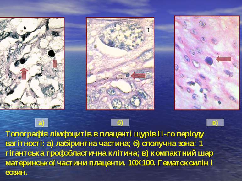 Топографія лімфоцитів в плаценті щурів ІІ-го періоду вагітності: а) лабіринтн...