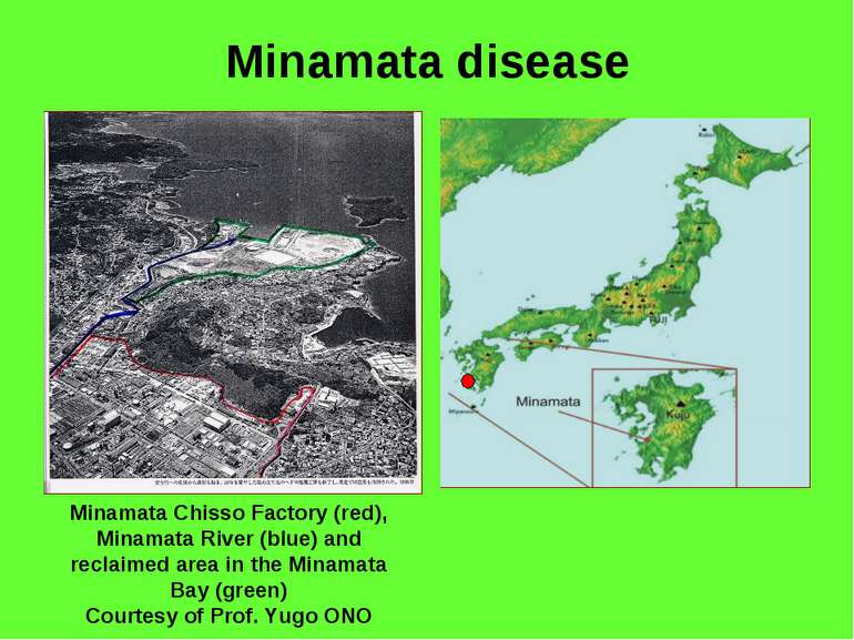 Minamata disease Minamata Chisso Factory (red), Minamata River (blue) and rec...