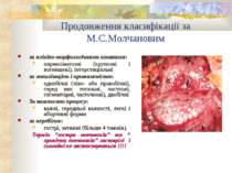 Продовження класифікації за М.С.Молчановим за клініко-морфологічними ознаками...