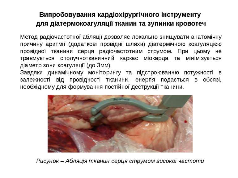 Випробовування кардіохірургічного інструменту для діатермокоагуляції тканин т...