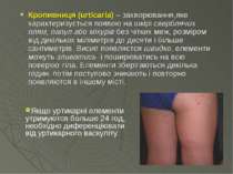 Кропивниця (urticaria) – захворювання,яке характеризується появою на шкірі св...