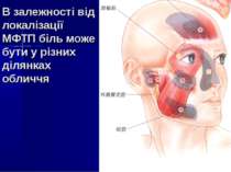 В залежності від локалізації МФТП біль може бути у різних ділянках обличчя