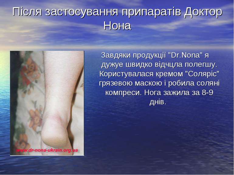 Після застосування припаратів Доктор Нона Завдяки продукції "Dr.Nona" я дужуе...