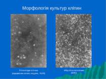 Морфологія культур клітин Епітеліоїдні клітини (карциноми легень людини, A549...