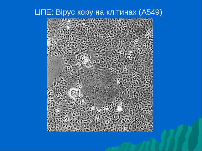 ЦПE: Вірус кору на клітинах (A549)