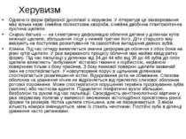 Херувизм Однією із форм фіброзної дисплазії є херувизм. У літературі це захво...