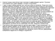 Клінічні ознаки амелобластоми пов'язані із деформацією щелеп. Пухлина спостер...