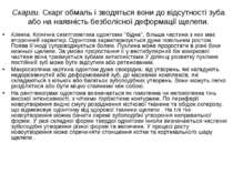 Скарги. Скарг обмаль і зводяться вони до відсутності зуба або на наявність бе...