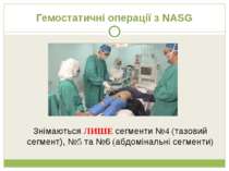 Гемостатичні операції з NASG Знімаються ЛИШЕ сегменти №4 (тазовий сегмент), №...