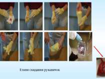 Етапи скидання рукавичок
