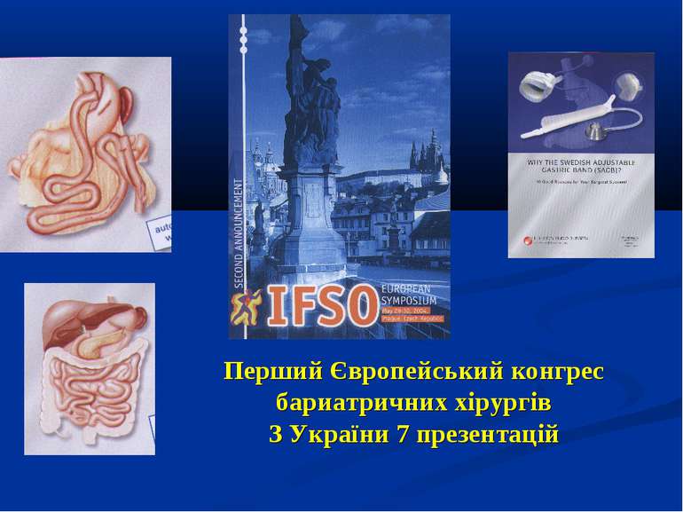 Перший Європейський конгрес бариатричних хірургів З України 7 презентацій