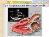 Трансторакальна ехокардіоскопія
