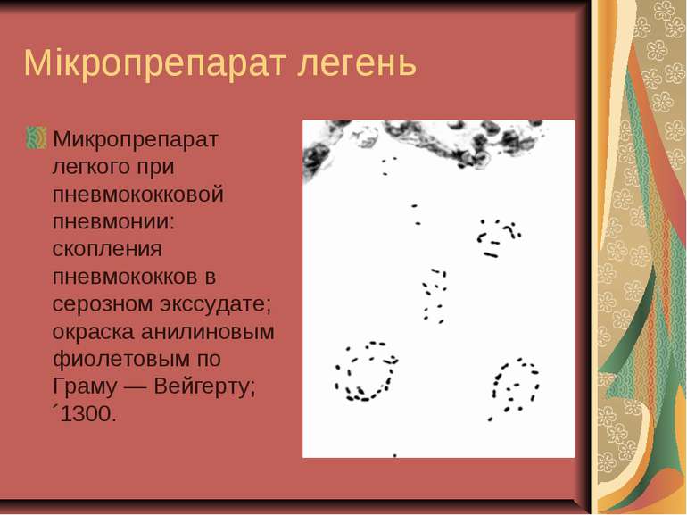 Мікропрепарат легень Микропрепарат легкого при пневмококковой пневмонии: скоп...