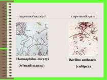 стрептобактерії стрептобацили Haemophilus ducreyi (м’який шанкр) Bacillus ant...