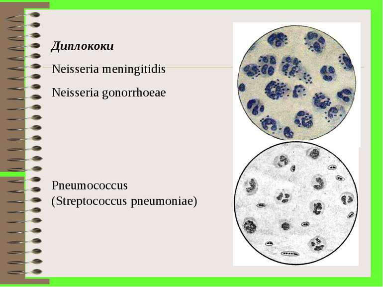 Диплококи Neisseria meningitidis Neisseria gonorrhoeae Pneumococcus (Streptoc...