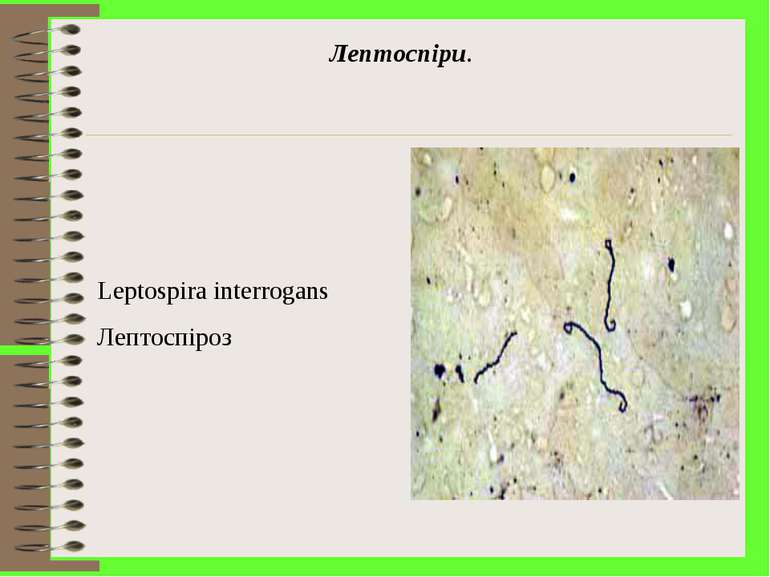 Лептоспіри. Leptospira interrogans Лептоспіроз