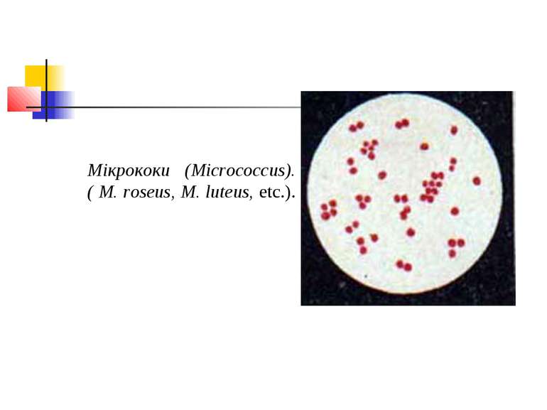 Мікрококи (Micrococcus). ( M. roseus, M. luteus, etc.).