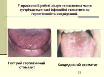 У практичній роботі лікаря-стоматолога часто зустрічаються такі інфекційні ст...