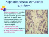 Характеристика клітинного атипізму: Поліморфізм клітин - розміри і форма пухл...