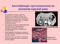Ампліфікація протоонкогенів як механізм індукції раку Як правило, клітинні он...