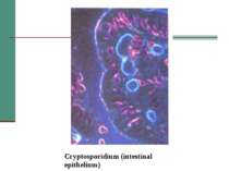 Cryptosporidium (intestinal epithelium)