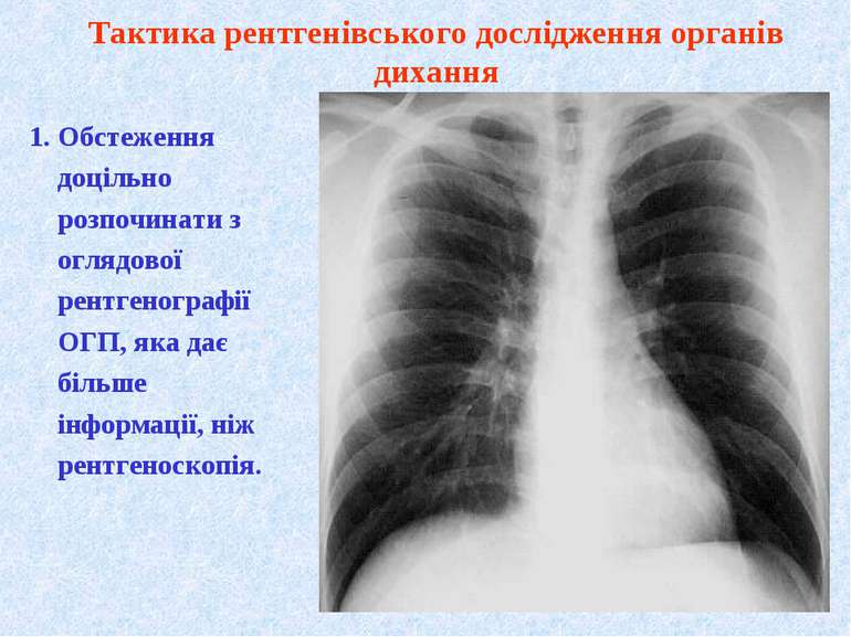 1. Обстеження доцільно розпочинати з оглядової рентгенографії ОГП, яка дає бі...