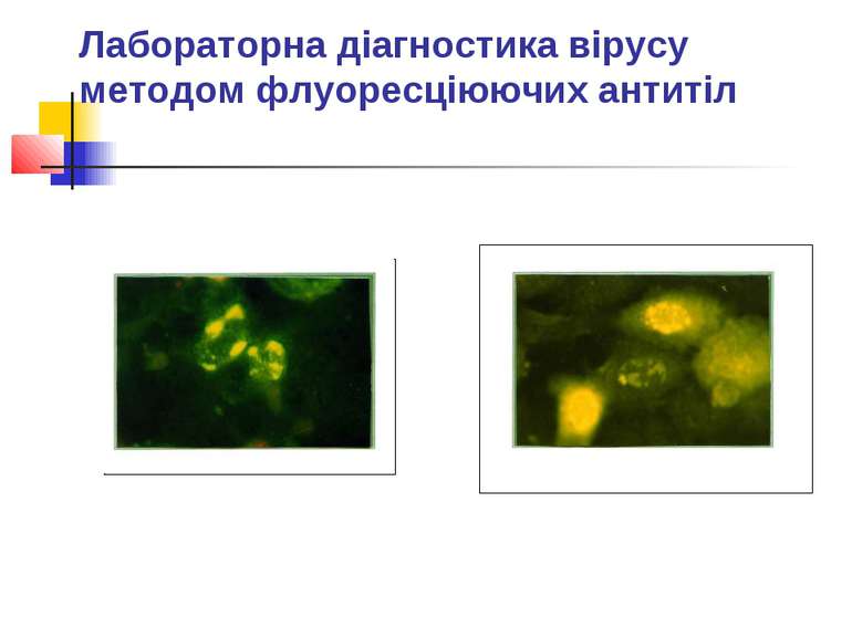 Лабораторна діагностика вірусу методом флуоресціюючих антитіл