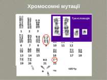 Хромосомні мутації Транслокація ТДМУ
