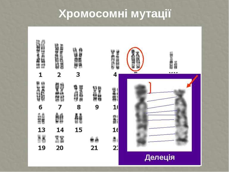 Хромосомні мутації Делеція ТДМУ