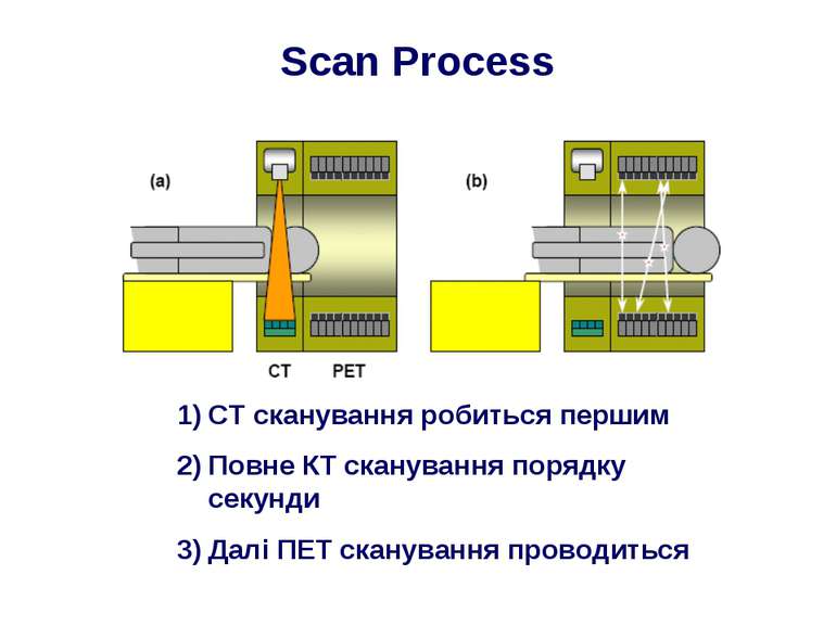 Scan Process CT сканування робиться першим Повне КТ сканування порядку секунд...
