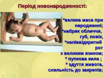 Період новонародженості: *велика маса при народженні; *набряк обличчя, губ, п...