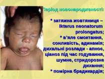 Період новонародженості: * затяжна жовтяниця – Ikterus neonatorum prolongatus...