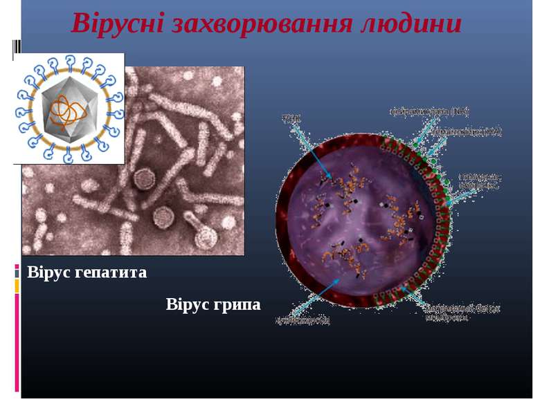 Вірусні захворювання людини Вірус гепатита Вірус грипа