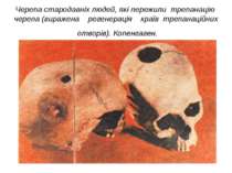 Черепа стародавніх людей, які пережили трепанацію черепа (виражена регенераці...