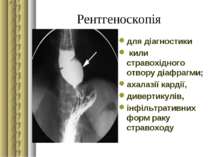 Рентгеноскопія для діагностики кили стравохідного отвору діафрагми; ахалазії ...