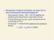 Величина напруги впливає на жорсткість рентгенівського випромінювання Для гру...