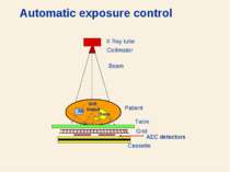 Automatic exposure control IAEA