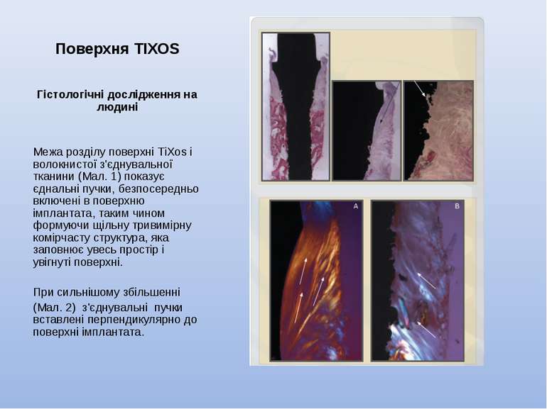Поверхня TIXOS Гістологічні дослідження на людині     Межа розділу поверхні T...