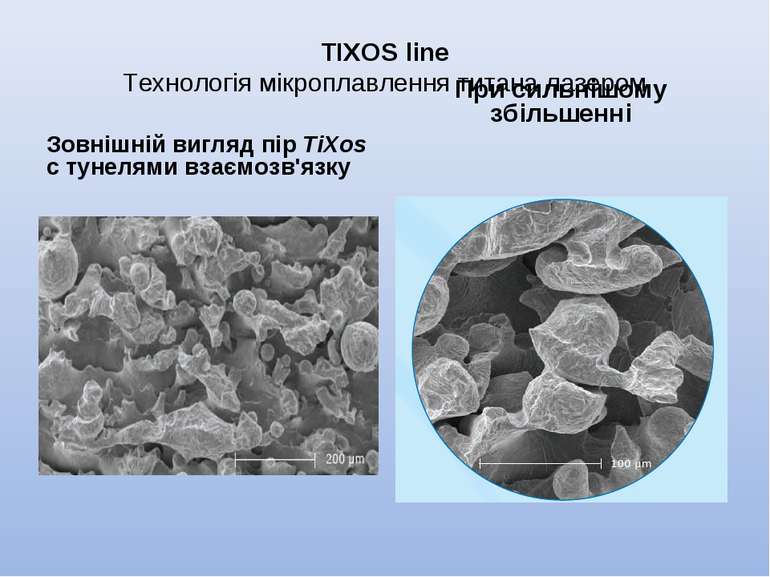 TIXOS line Технологія мікроплавлення титана лазером Зовнішній вигляд пір TiХo...