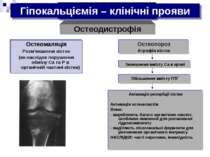 Гіпокальциемія Остеомаляція Розм'якшення кісток (як наслідок порушення обміну...