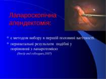 Лапароскопічна апендектомія: є методом вибору в першій половині вагітності. п...