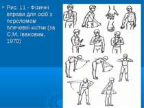Рис. 11 - Фізичні вправи для осіб з переломом плечової кістки (за С.М. Іванов...